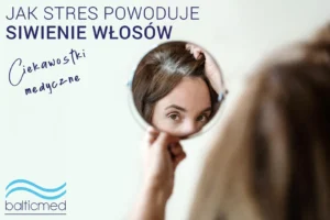 Ciekawostki Medyczne Jak Stres Wplywa Na Siwienie Wlosow – Balticmed